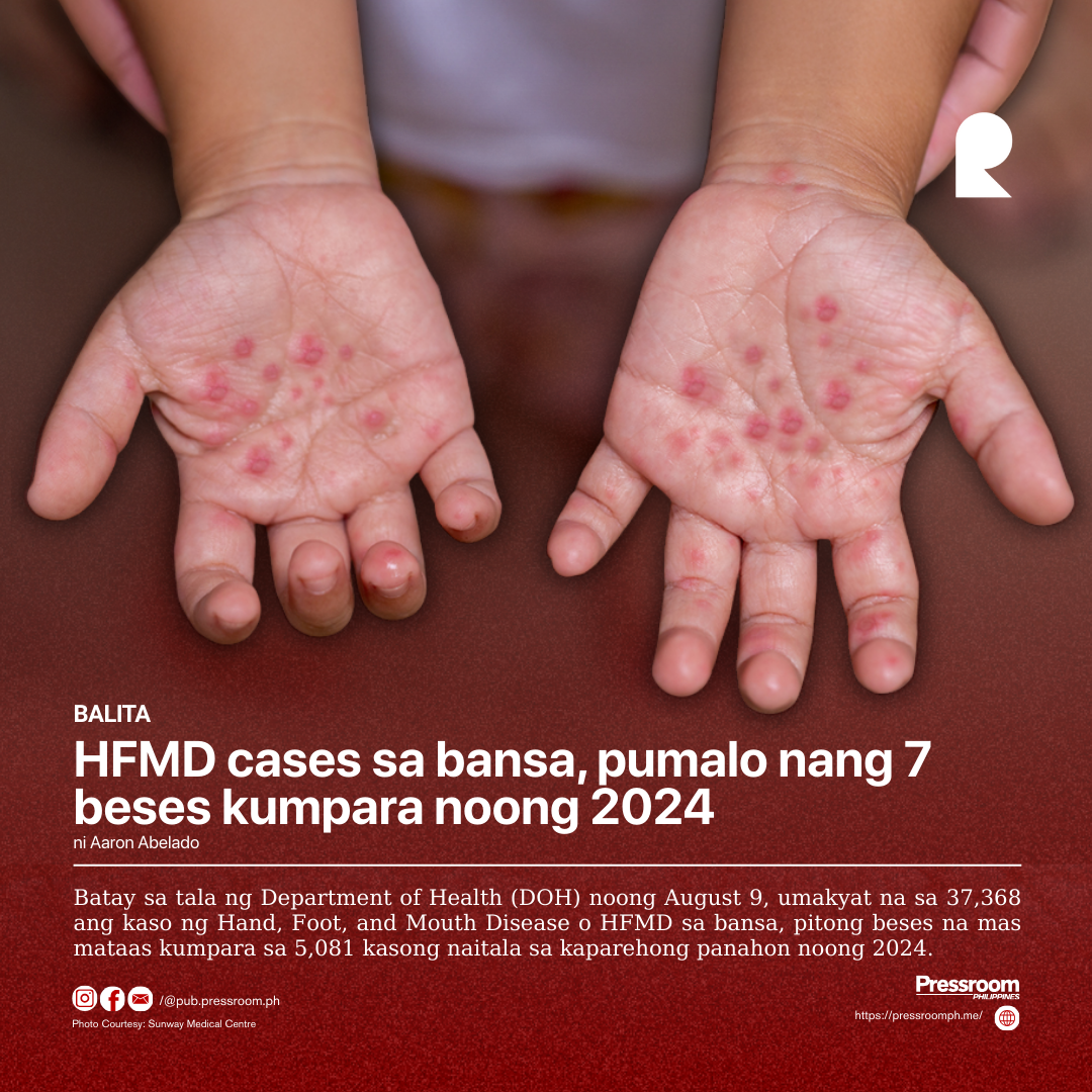 HFMD cases sa bansa, pumalo nang 7 beses kumpara noong 2024